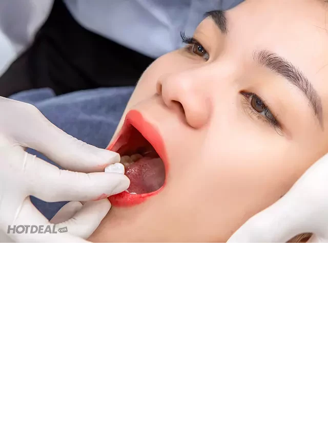   Bọc Răng Sứ Không Giới Hạn Tại Viện Nha Khoa Thẩm Mỹ Miley Dental - Làm Nụ Cười Tự Tin Hơn